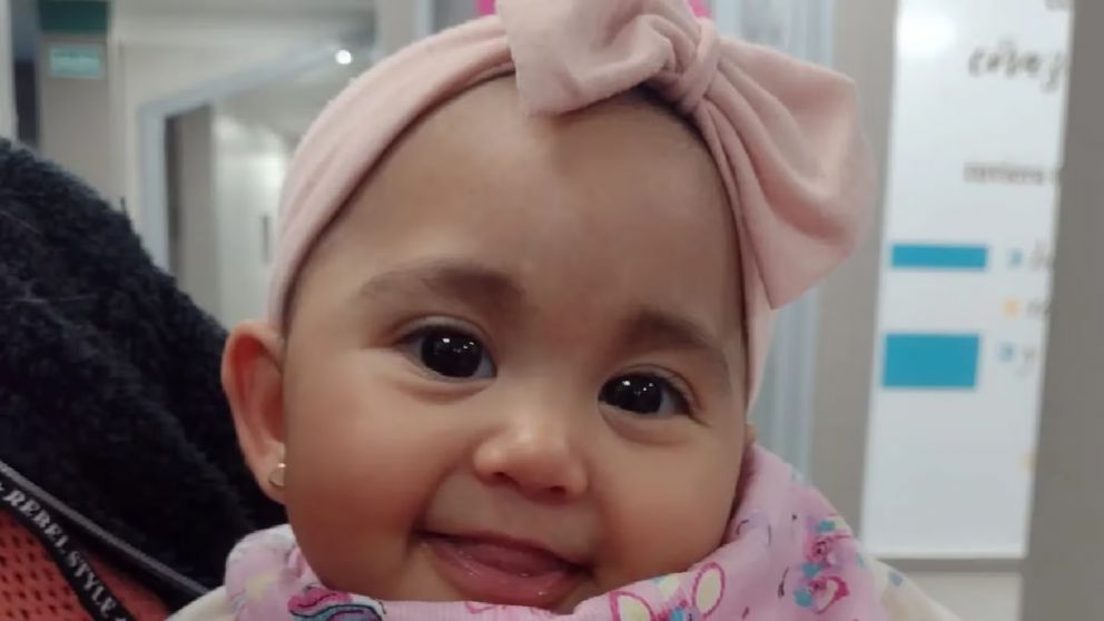 Una beba mendocina necesita operarse de urgencia por una rara condici�n: “Su frente est� creciendo en tri�ngulo”