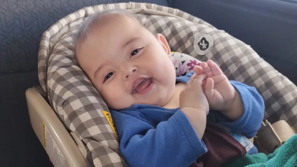 Un beb� mendocino necesita un costoso casco protector para sobrevivir tras una cirug�a y la familia pide ayuda