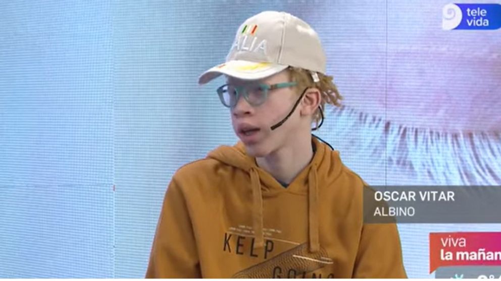 Un niño albino rescatado de África y adoptado en Mendoza visibiliza una realidad estremecedora