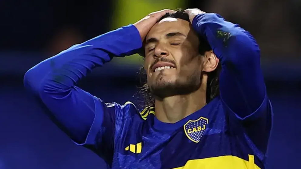 El jugador Edinson Cavani presenta una distensión del Psoas derecho.