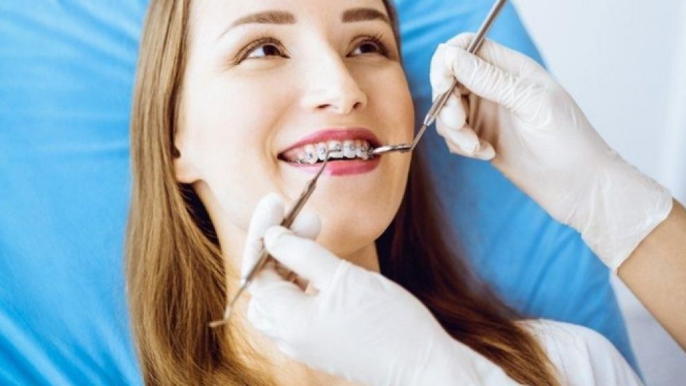 Tipos de ortodoncia: conocé qué tratamiento se adapta mejor a tu sonrisa