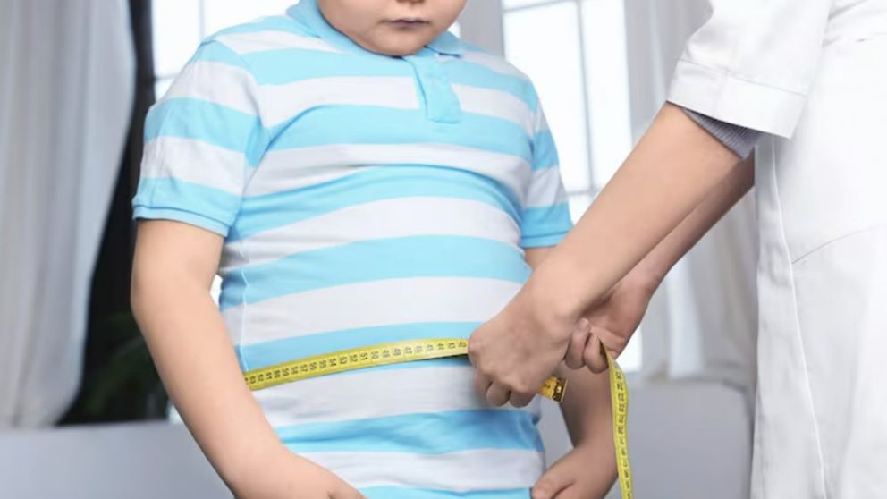 Un informe de la UBA alertó por altos índices de sobrepeso infantil en un departamento de Mendoza
